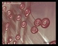 escherichia coli